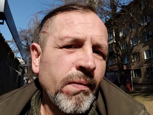 Избиение экс-политзаключенного с инвалидностью в ТЦК в Киеве, полиция начала проверку. Что ответили в военкомате?